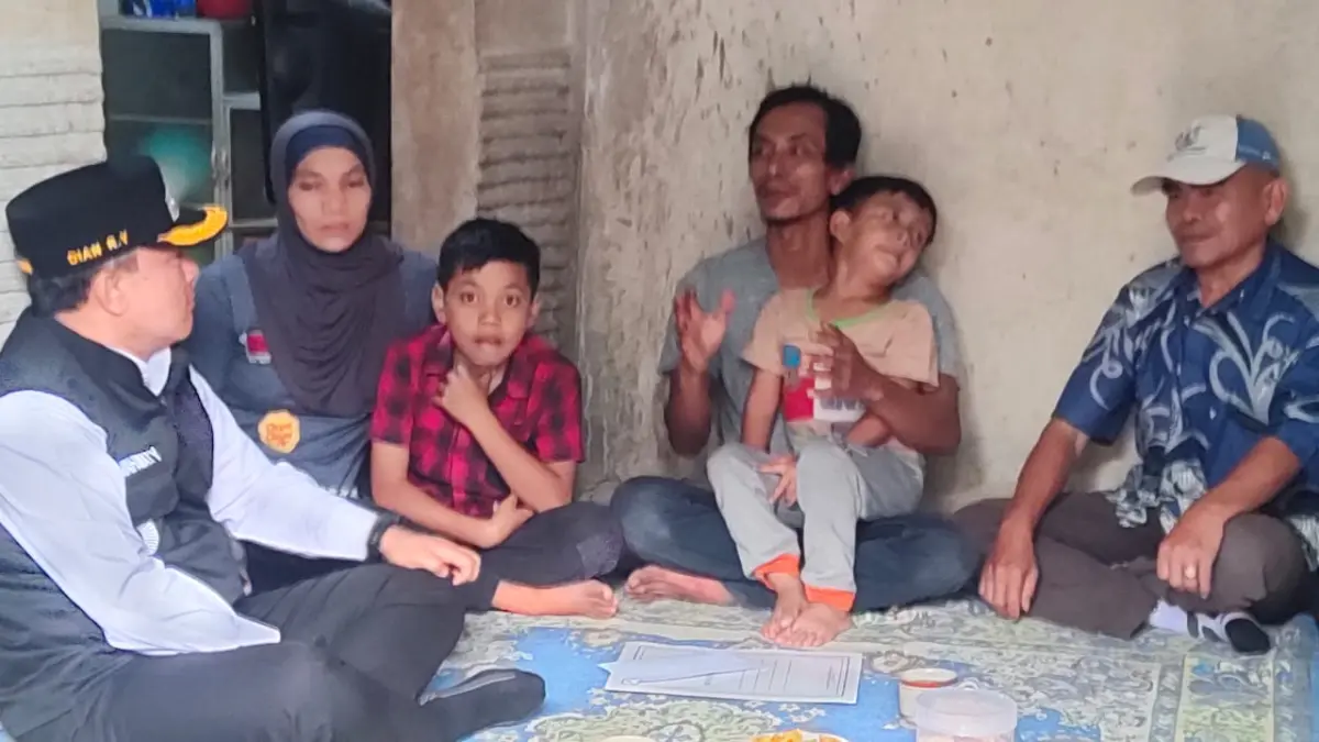 Bupati Kuningan bantu anak penderita tumor pembuluh darah.